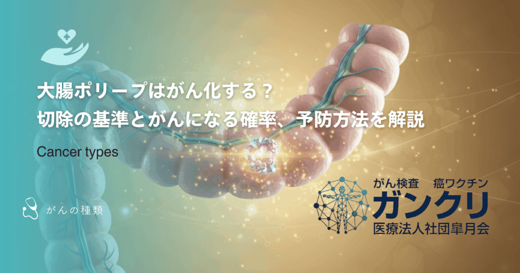 大腸ポリープはがん化する？切除の基準とがんになる確率、予防方法を解説