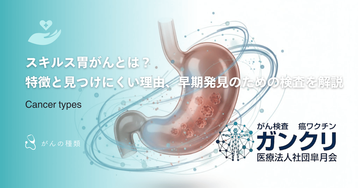 スキルス胃がんとは？特徴と見つけにくい理由、早期発見のための検査を解説