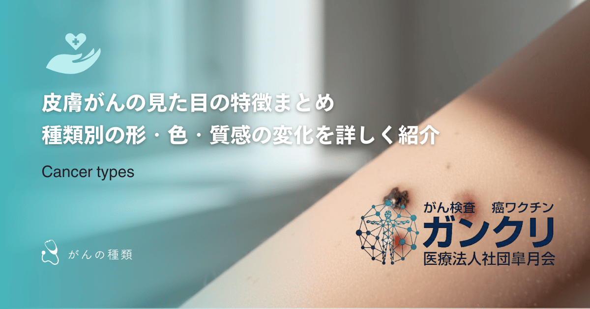 皮膚がんの見た目の特徴まとめ｜種類別の形・色・質感の変化を詳しく紹介