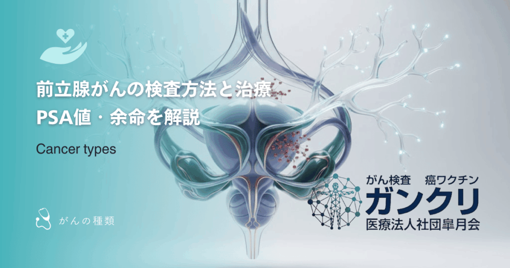 前立腺がんの検査方法と治療｜PSA値・余命を解説