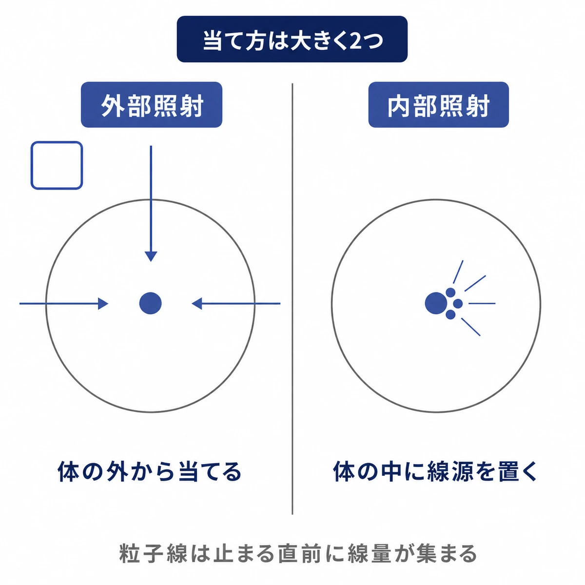 放射線を体の外から当てる外部照射と体の中に線源を置く内部照射の違いを円と矢印で比べた図解イラスト