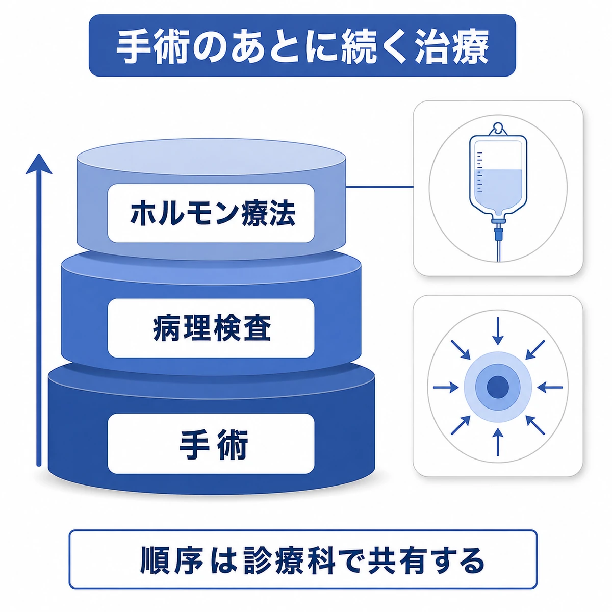 手術、病理検査、ホルモン療法を下から順に重ね、点滴や放射線治療との組み合わせを描いた構造図