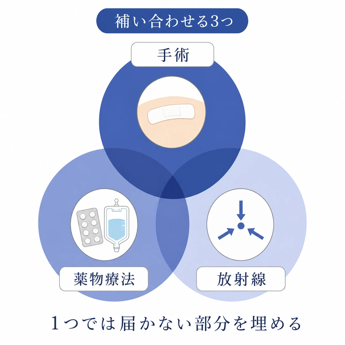 手術・薬物療法・放射線治療が互いを補う集学的治療を、重なり合う3つの円で表した図
