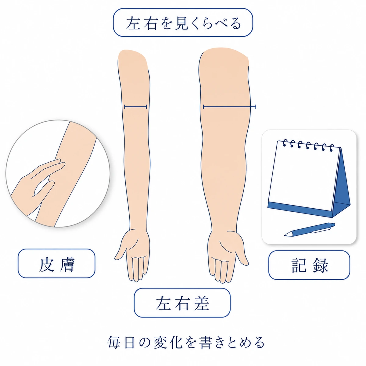 むくみを確かめるために左右の腕と皮膚を見比べ、毎日の変化を記録するポイントをまとめた図解