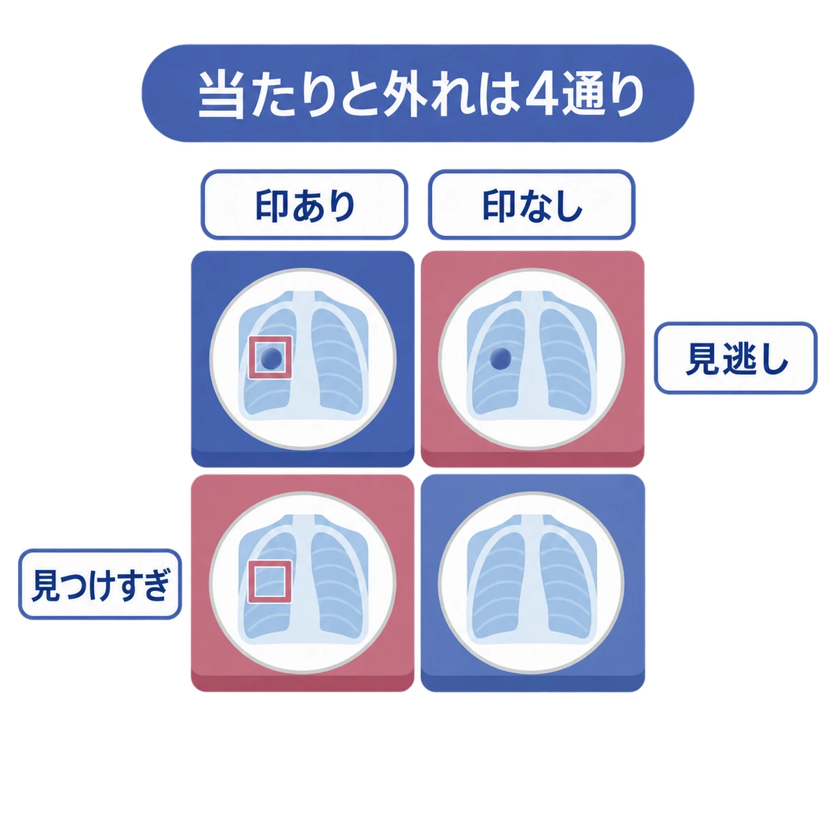 がんの有無とAIによる印の有無を組み合わせ、見逃しや見つけすぎを整理した図
